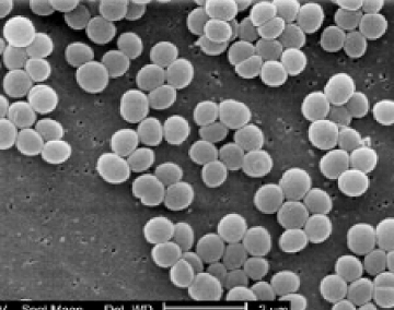 黄色ブドウ球菌｜オゾンの除菌｜ウイルス除菌サービス実施中｜取手・守谷・土浦でリフォームなら幸和建築工房